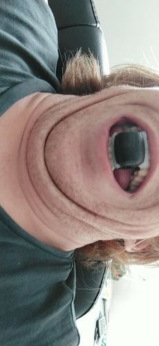 Customer photo review of Jawzrsize Musculation Mâchoire Carré