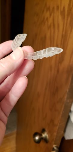 Customer photo review of Night Guard - Yearly