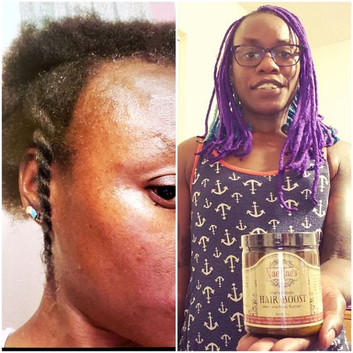 Customer photo review of Nae Nae's Hair Boost 9oz