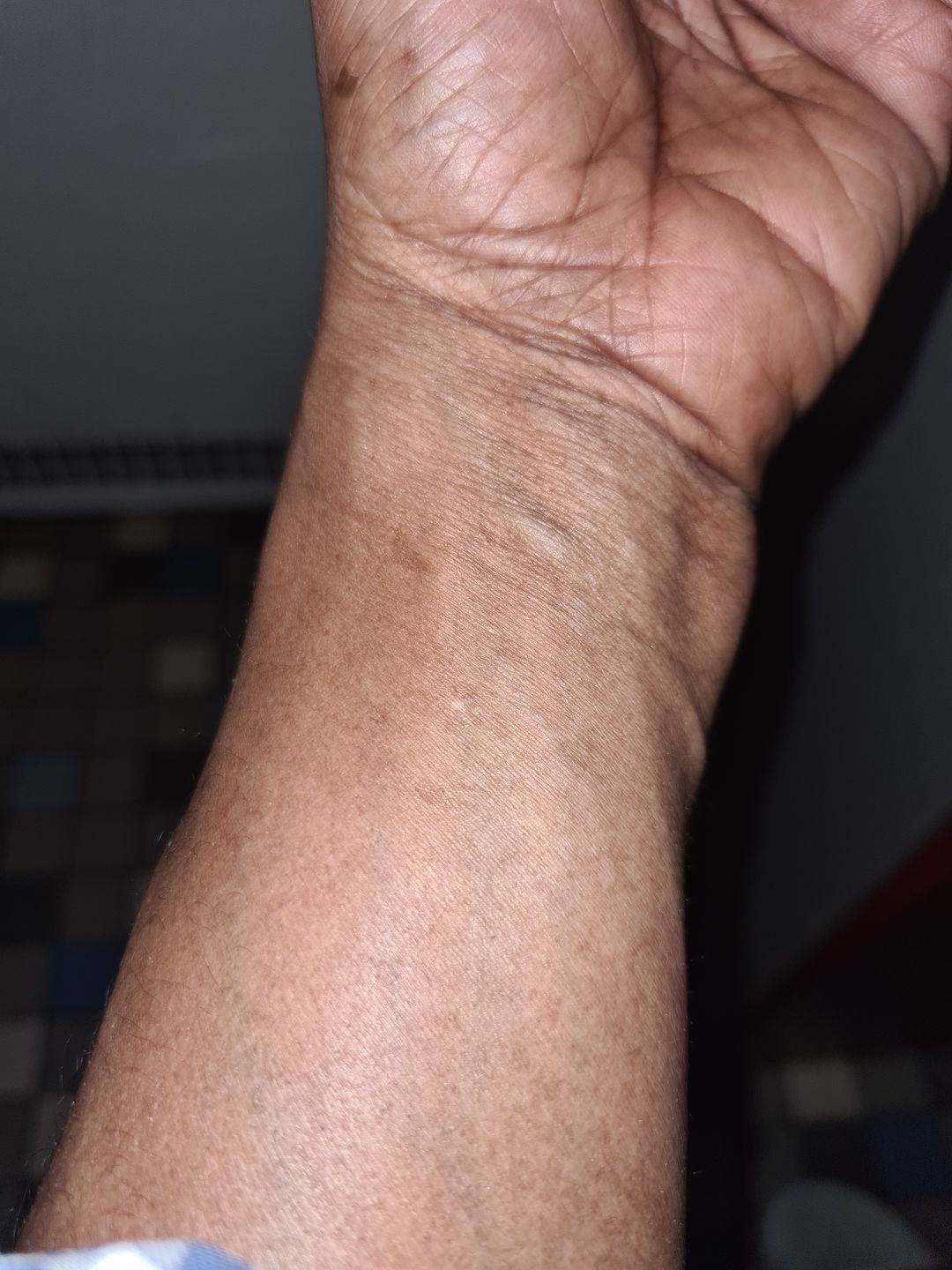 Customer photo review of Omic LightenUp Anti-Aging Lightening Body Lotion - 400ml