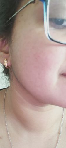 Customer photo review of Niacid