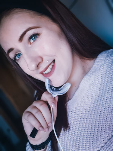 Customer photo review of SmileSecret Phonebleaching®