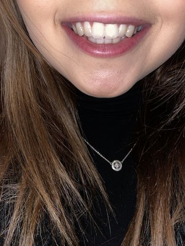 Customer photo review of Teeth Whitening Kit