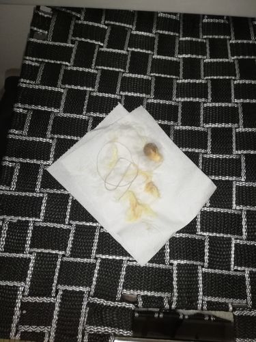 Customer photo review of Perle de Detox Vaginale (Lot de 3 perles par sachet)