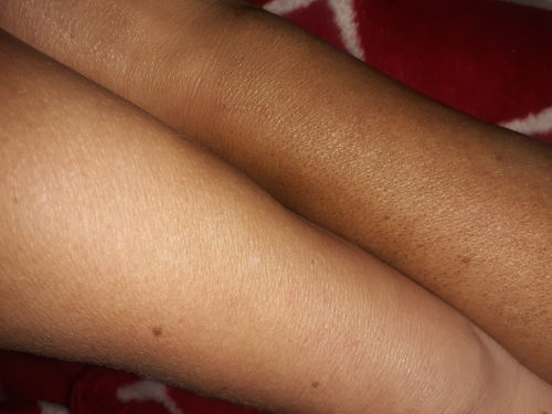 Customer photo review of Desert Bronze Self Tanning Mousse **READY TO SHIP**