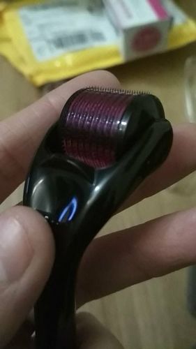 Customer photo review of Premium Dermaroller mit 540 Titan Nadeln