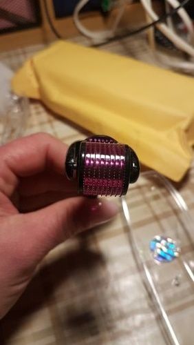 Customer photo review of Premium Dermaroller mit 540 Titan Nadeln