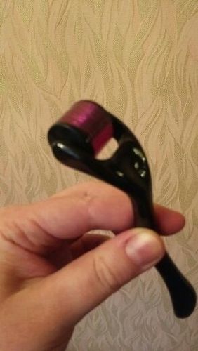 Customer photo review of Premium Dermaroller mit 540 Titan Nadeln