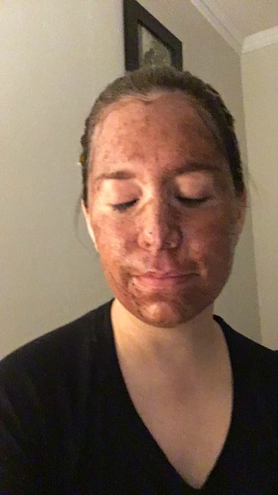 Customer photo review of Exfoliante / Mascarilla Facial de Tepezcohuite y 5 arcillas