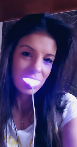 Customer photo review of SmileSecret Refill Pens