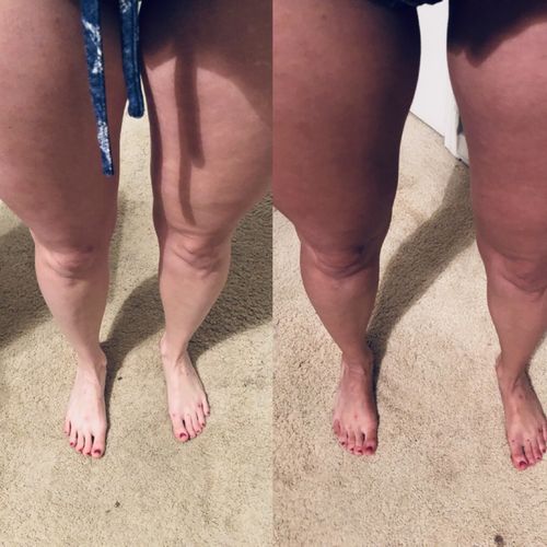 Customer photo review of Desert Bronze Self Tanning Mousse **READY TO SHIP**