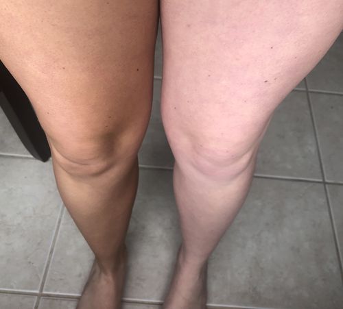 Customer photo review of Desert Bronze Self Tanning Mousse **READY TO SHIP**