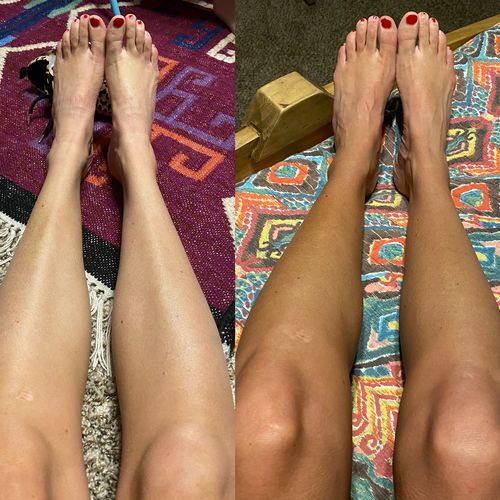 Customer photo review of Desert Bronze Self Tanning Mousse **READY TO SHIP**