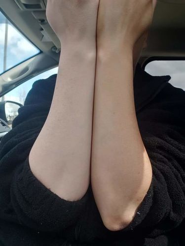 Customer photo review of Defective Bottle