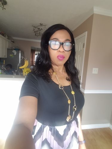 Customer photo review of Fair and White Exclusive Gel Cream 30ml / 1 fl oz