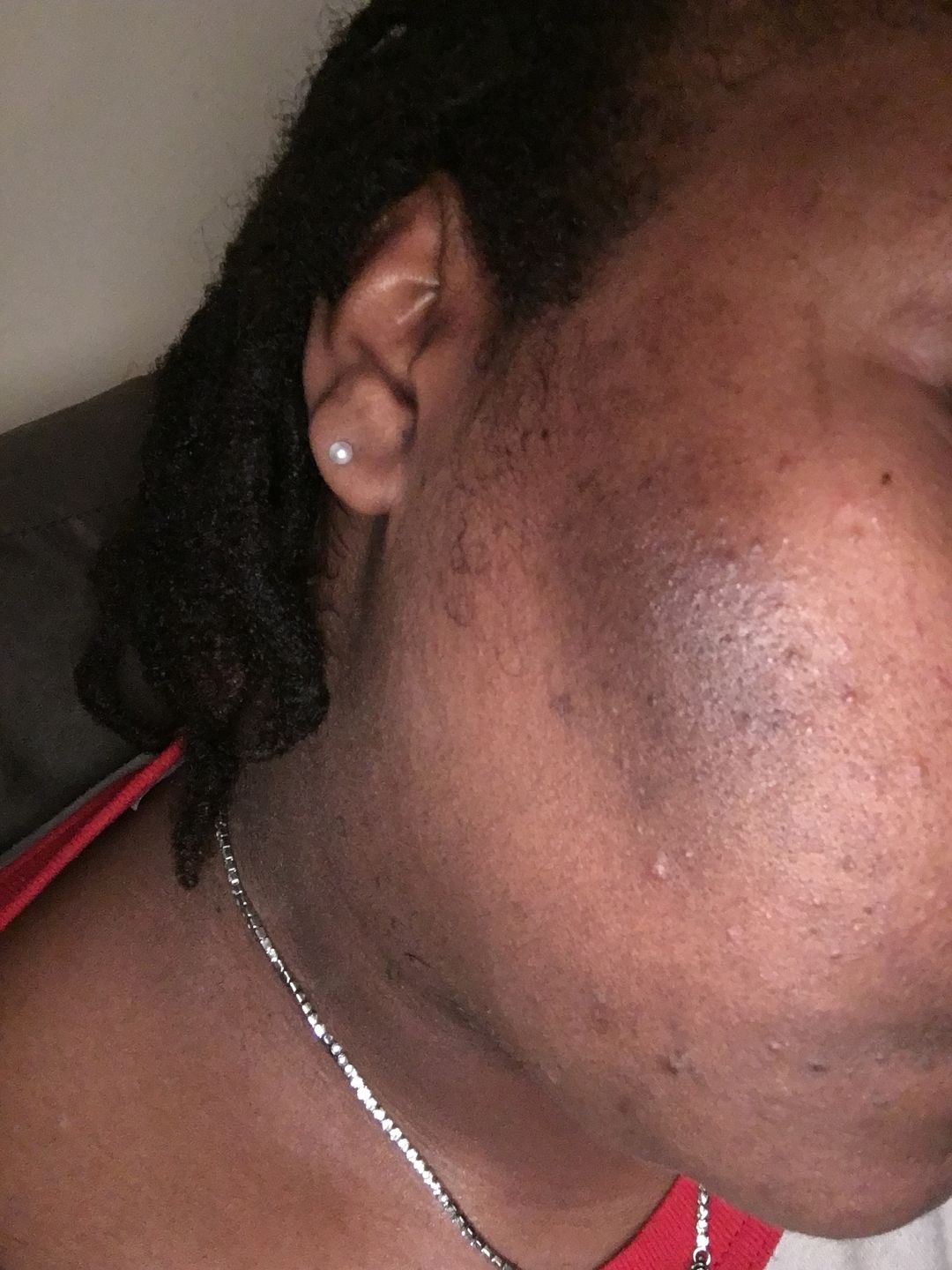Customer photo review of SPF 30 Brightening Moisturizer