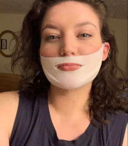 Customer photo review of DermaV™  |  Masque amincissant pour ovale du visage