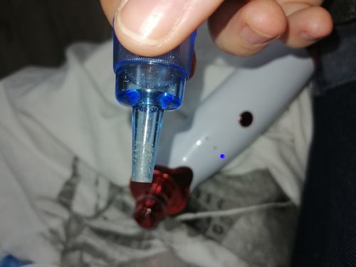 Customer photo review of Aspirateur Points Noirs