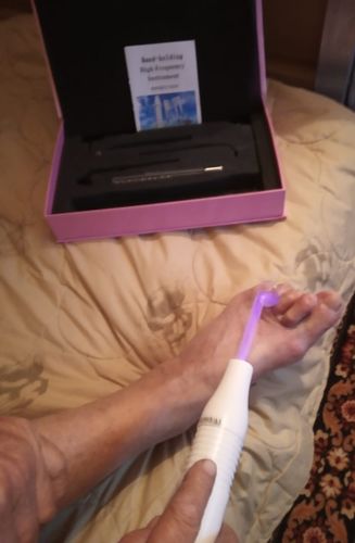 Customer photo review of EverBelle™ High Frequency Skin Rejuvenator (4 in 1)
