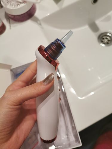 Customer photo review of Aspirateur Points Noirs