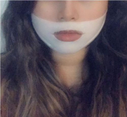 Customer photo review of DermaV™  |  Masque amincissant pour ovale du visage