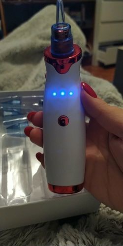 Customer photo review of Aspirateur Points Noirs