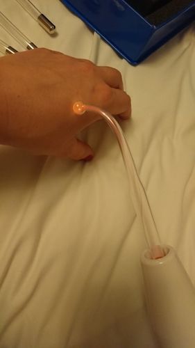 Customer photo review of EverBelle™ High Frequency Skin Rejuvenator (4 in 1)