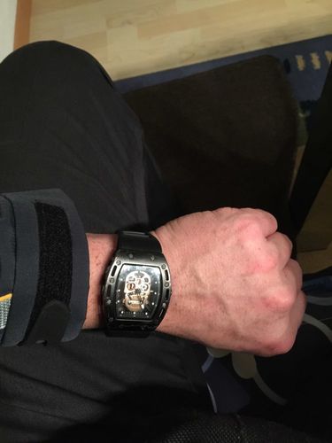 Customer photo review of The Skeleton Exclusive Watch