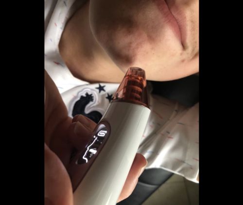 Customer photo review of HAUTREINIGER Maggy Beauty™