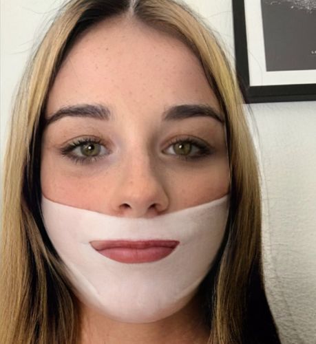 Customer photo review of DermaV™  |  Masque amincissant pour ovale du visage