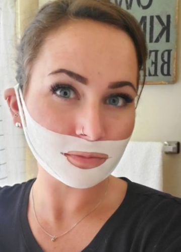 Customer photo review of DermaV™  |  Masque amincissant pour ovale du visage