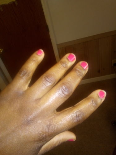 Customer photo review of Fair and White So White Skin Perfector Gel 30ml / 1 fl oz