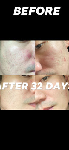 Customer photo review of Niacid