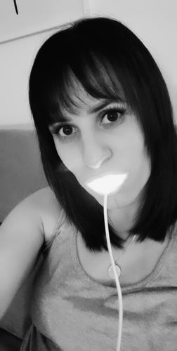 Customer photo review of PAP+ LED Teeth Whitening Kit