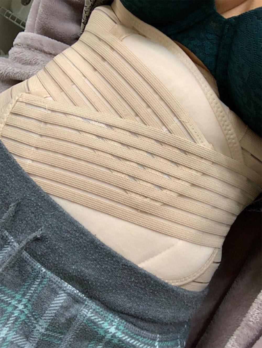Customer photo review of 3 in 1 Postpartum Recovery Belt (40% OFF NOW!)