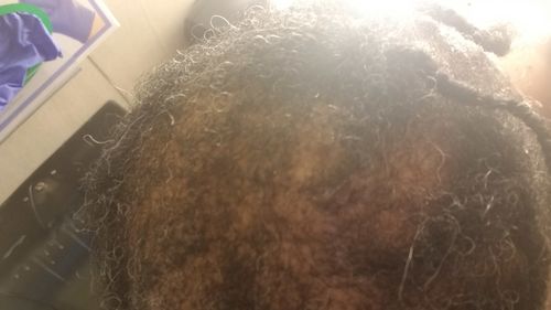 Customer photo review of Nae Nae's Hair Boost 9oz