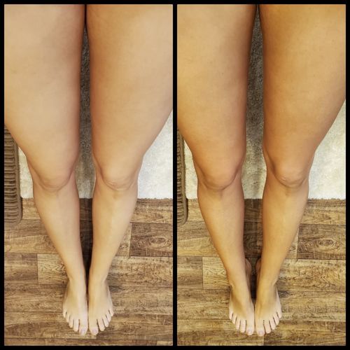 Customer photo review of WHOLESALE BOTTLE W/MITT