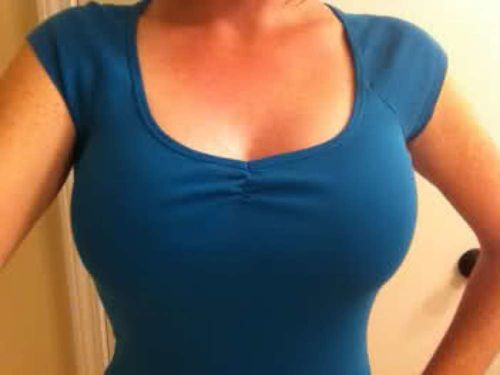 Customer photo review of Anti-Sagging Bra
