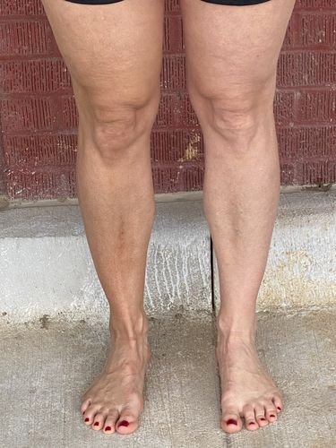 Customer photo review of Defective Bottle