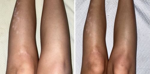 Customer photo review of Desert Bronze Self Tanning Mousse READY TO SHIP!!