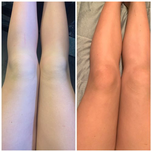 Customer photo review of Desert Bronze Self Tanning Mousse READY TO SHIP!!