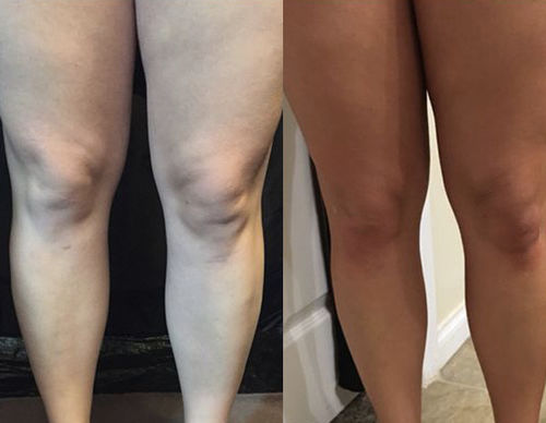 Customer photo review of Le Kit bronzage