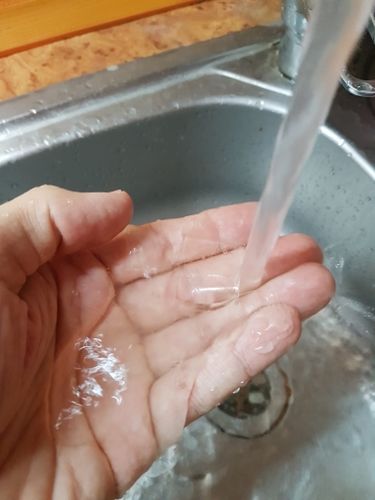 Customer photo review of Reusable Double-Sided Gel Sticky Tape 【LAST DAY PROMOTION】