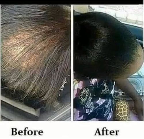 Customer photo review of Omez Beauty products  - Chebe Hair Grease