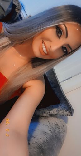 Customer photo review of Teeth Whitening Kit