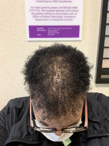 Customer photo review of Nae Nae's Hair Boost 9oz