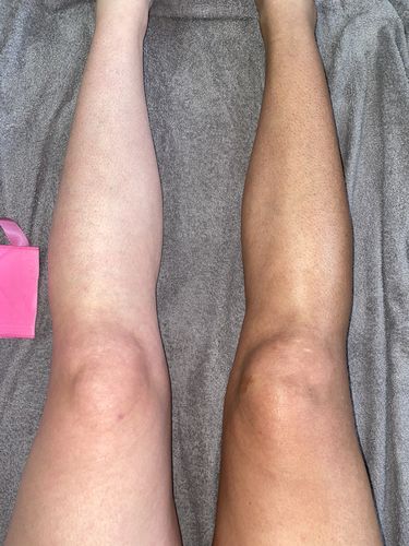 Customer photo review of Desert Bronze Self Tanning Mousse READY TO SHIP!!