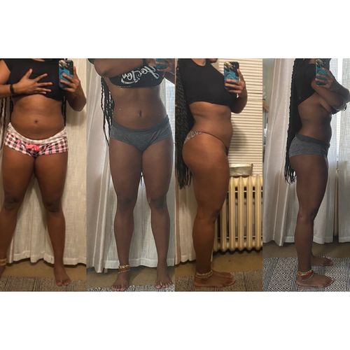 Customer photo review of Renew Body and Skin Repair Bundle