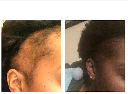 Customer photo review of Omez Beauty products - Authentic Chebe Powder