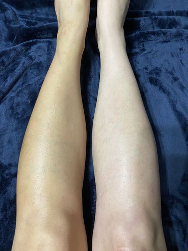 Customer photo review of WHOLESALE BOTTLE W/MITT